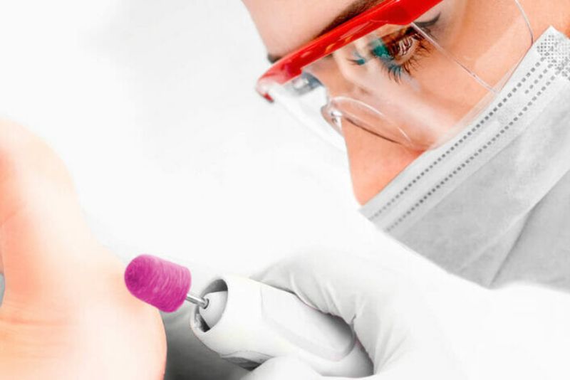 Cappucci Abrasivi per Pedicure
