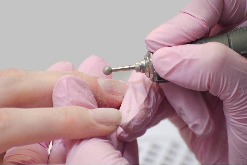 Cuticole: le tipologie più comuni